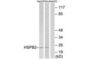 Western blot analysis of extracts from HepG2/HeLa cells, using HSPB2 Antibody. (HSPB2 anticorps  (AA 121-170))