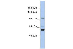 TRPM8 antibody used at 1 ug/ml to detect target protein.
