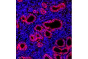 Immunofluorescence of paraffin embedded mouse uterus using CK13 (ABIN7074411) at dilution of 1:500 (400x lens) (Cytokeratin 13 anticorps  (C-Term))