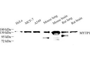 Western blot analysis of MYTP1 (ABIN7074731) at dilution of 1: 500 (Myosin Binding Subunit anticorps)
