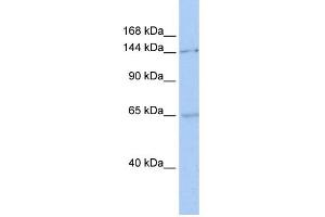 WB Suggested Anti-SMC1A Antibody Titration:  0. (SMC1A anticorps  (C-Term))