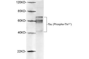 Western blot analysis of rat brain lysates using 1 µg/mL Antibodies-Online Rabbit Anti-Tau (Phospho-Thr217) Polyclonal Antibody (ABIN398308) The signal was developed with IRDyeTM 800 Conjugated Goat Anti-Rabbit IgG. (tau anticorps  (pThr217))