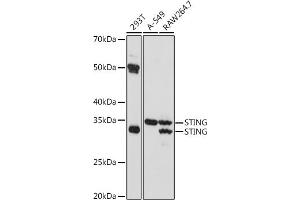 Western blot analysis of extracts of various cell lines, using STING antibody (ABIN7270958) at 1:1000 dilution. (STING/TMEM173 anticorps)