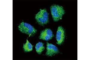 Confocal immunofluorescent analysis of CHAT antibody with NCI-H460 cells followed by Alexa Fluor 488-conjugated goat anti-rabbit lgG (green). (Choline Acetyltransferase anticorps  (AA 98-128))