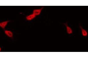 ABIN6267469 staining RAW264. (CDC25C anticorps  (pSer216))