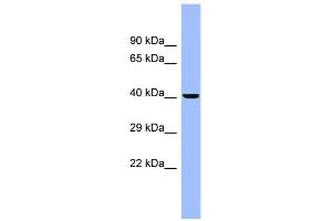 WB Suggested Anti-CEACAM6 Antibody Titration:  0. (CEACAM6 anticorps  (N-Term))