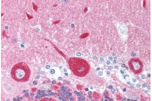 Human Brain, Cerebellum (formalin-fixed, paraffin-embedded) stained with FREQ antibody ABIN214036 at 5 ug/ml followed by biotinylated goat anti-rabbit IgG secondary antibody ABIN481713, alkaline phosphatase-streptavidin and chromogen. (NCS1 anticorps)
