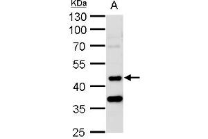 WB Image STK24 antibody [N2C1], Internal detects STK24 protein by western blot analysis. (STK24 anticorps)