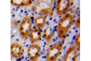 Used in DAB staining on fromalin fixed paraffin-embedded Kidney tissue