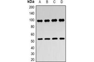 Western blot analysis of ZASP expression in Hela (A), MCF7 (B), mouse skeletal muscle (C), rat skeletal muscle (D) whole cell lysates. (LIM Domain Binding 3 Protein anticorps)