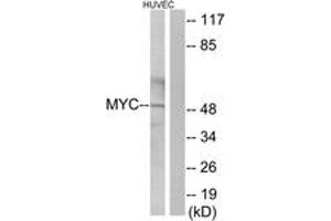 Western blot analysis of extracts from HuvEc cells, using MYC Antibody. (c-MYC anticorps  (AA 386-435))