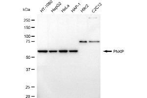 Western blotting analysis using PNKP antibody (ABIN7799881).