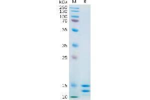 Human IL2 Protein, His Tag on SDS-PAGE under reducing condition.