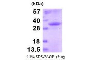 Figure annotation denotes ug of protein loaded and % gel used. (Recombinant Souris IgG Isotype Control)