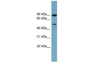WB Suggested Anti-PI4K2B Antibody Titration: 0. (PI4K2B anticorps  (Middle Region))
