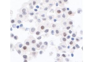 Immunohistochemistry (IHC) image for anti-Protein Phosphatase 1, Catalytic Subunit, alpha Isoform (PPP1CA) (C-Term) antibody (ABIN7454526)