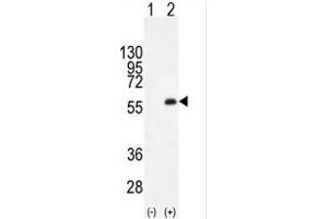 Western blot analysis of PKMYT1 (arrow) using rabbit polyclonal PKMYT1 C-term (ABIN391292 and ABIN2841332).