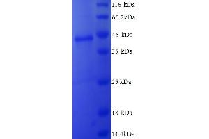 SDS-PAGE (SDS) image for Collagen, Type XVIII, alpha 1 (COL18A1) (AA 1578-1754) protein (His tag) (ABIN5713372)