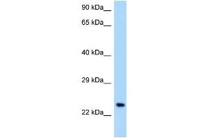 WB Suggested Anti-OSCAR Antibody Titration: 1. (OSCAR anticorps  (C-Term))