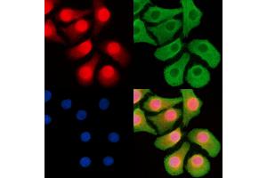 ABIN6263498 and ABIN6268752 staining Hela cells by IF/ICC.