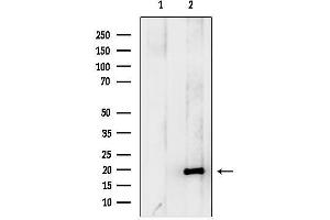 Western blot analysis of lysates from F10 cells, using Hippocalcin Antibody.