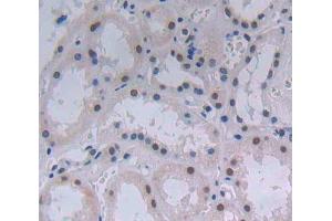 IHC-P analysis of Human Tissue, with DAB staining. (ATF3 anticorps  (AA 1-181))