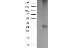 Western Blotting (WB) image for anti-T-cell surface glycoprotein CD1c (CD1C) antibody (ABIN1497187) (CD1c anticorps)