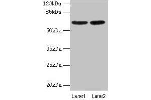 Western Blot All lanes: NELFB antibody at 2 μg/mL Lane 1: NIH/3T3 whole cell lysate Lane 2: HL60 whole cell lysate Secondary Goat polyclonal to rabbit IgG at 1/15000 dilution Predicted band size: 66 kDa Observed band size: 66 kDa