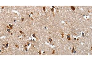 Immunohistochemistry of paraffin-embedded Human brain tissue using LAMA1 Polyclonal Antibody at dilution of 1:70