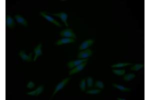 Detection of CASP9 in Human HepG2 cell using Polyclonal Antibody to Caspase 9 (CASP9)