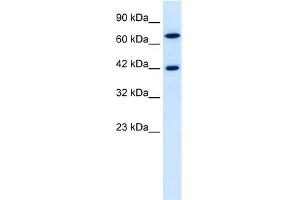 WB Suggested Anti-C20ORF100 Antibody Titration: 0. (TOX2 anticorps  (N-Term))