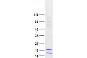 Validation with Western Blot