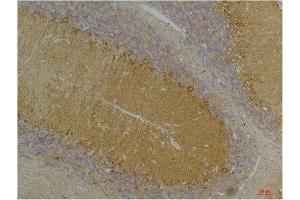 Immunohistochemical analysis of paraffin-embedded Rat BrainTissue using KCNN3(SK3) Rabbit pAb diluted at 1:200. (KCNN3 anticorps)