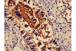 Immunohistochemistry of paraffin-embedded human lung tissue using ABIN7143831 at dilution of 1:100