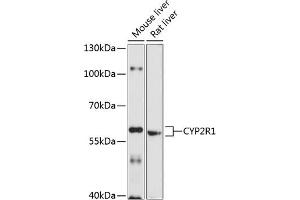 Western blot analysis of extracts of various cell lines, using CYP2R1 antibody (ABIN6130162, ABIN6139341, ABIN6139342 and ABIN6214739) at 1:1000 dilution.