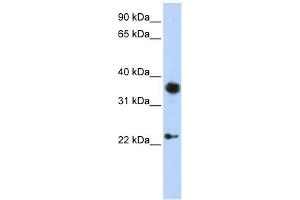 EN1 antibody used at 1 ug/ml to detect target protein.