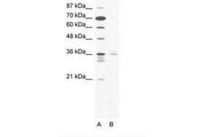 Image no. 1 for anti-LIM Homeobox 3 (LHX3) (AA 230-279) antibody (ABIN203106) (LHX3 anticorps  (AA 230-279))