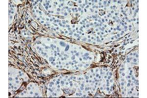 Image no. 4 for anti-Alcohol Dehydrogenase 1B (Class I), beta Polypeptide (ADH1B) antibody (ABIN1496479) (ADH1B anticorps)