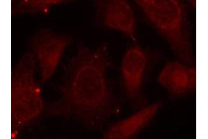 Immunofluorescence staining of methanol-fixed Hela cells using Phospho-NF2-S518 antibody.