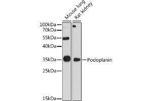 Western blot analysis of extracts of various cell lines, using Podoplanin antibody (ABIN6128559, ABIN6145406, ABIN6145409 and ABIN6217196) at 1:1000 dilution. (Podoplanin anticorps)