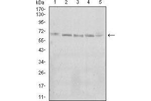 Western blot analysis using KBTBD8 mouse mAb against A431 (1), Jurkat (2), Hela (3), K562 (4), and HEK293 (5) cell lysate. (KBTBD8 anticorps  (AA 264-464))