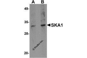 Western Blotting (WB) image for anti-Spindle and Kinetochore Associated Complex Subunit 1 (SKA1) (C-Term) antibody (ABIN1030667) (SKA1 anticorps  (C-Term))