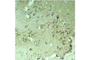 Image no. 1 for anti-Microtubule-Associated Protein tau (MAPT) (Ser396) antibody (ABIN197256)