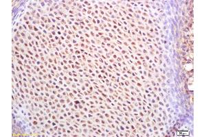 Formalin-fixed and paraffin embedded mouse embryo labeled with Rabbit Anti IGF2BP1/IMP1 Polyclonal Antibody, Unconjugated (ABIN1386018) at 1:200 followed by conjugation to the secondary antibody and DAB staining