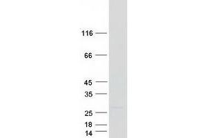 Validation with Western Blot