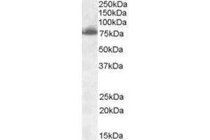 Western Blotting (WB) image for anti-delta-Like 1 (DLL1) (Internal Region) antibody (ABIN2473310)