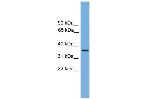 WB Suggested Anti-SPRY4 Antibody Titration:  0. (SPRY4 anticorps  (Middle Region))