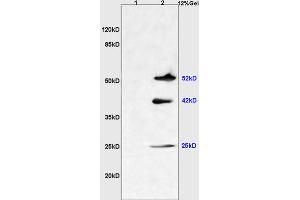 L1 mouse liver lysates L2 mouse brain lysates probed with Anti NGX6/C9orf127 Polyclonal Antibody, Unconjugated (ABIN737136) at 1:200 overnight at 4 °C. (TMEM8B anticorps  (AA 21-120))