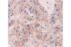 IHC-P analysis of liver tissue, with DAB staining. (ACAA1 anticorps  (AA 182-424))