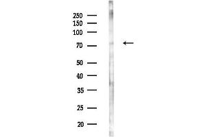 Western blot analysis of lysates from EC304 cells(heat-shock treatment), using NDUFS1 Antibody at 1/1000 dilution.